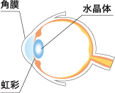 白内障 イメージ