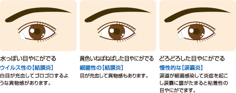 目やにがでる よしづ眼科 Jr桜木町駅徒歩1分 みなとみらい駅徒歩7分の眼科